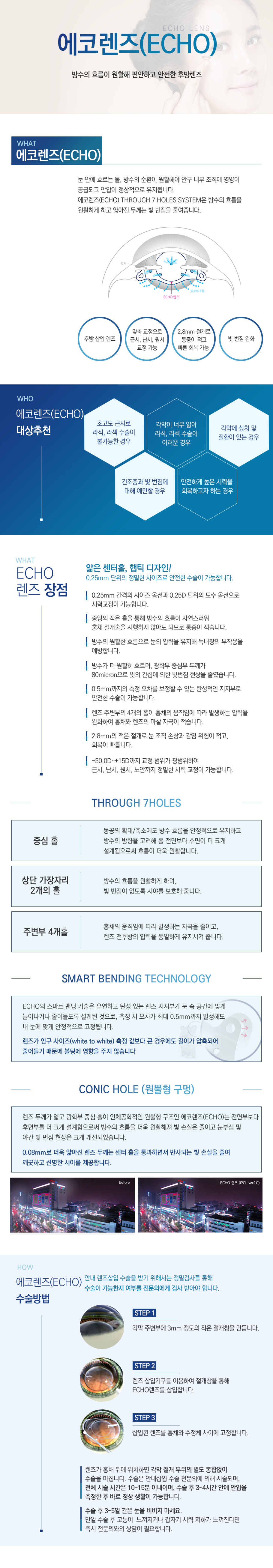 echo렌즈