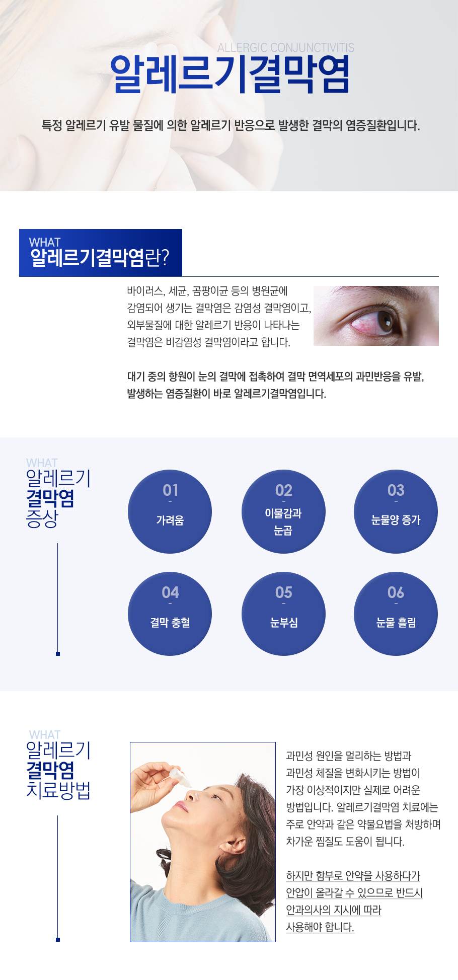 알러지성결막염