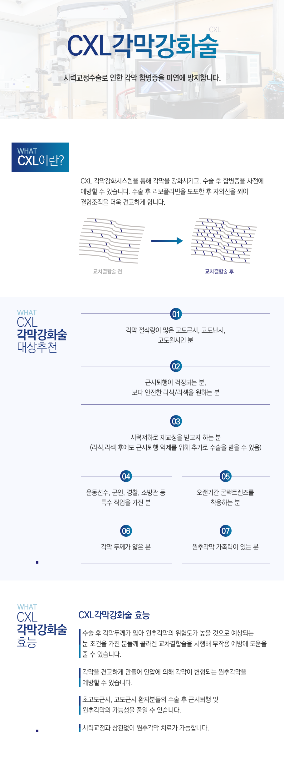 CXL 각막강화술