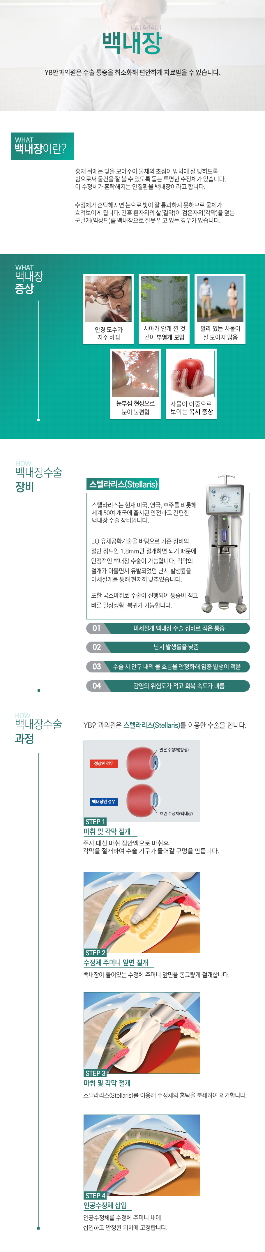 백내장