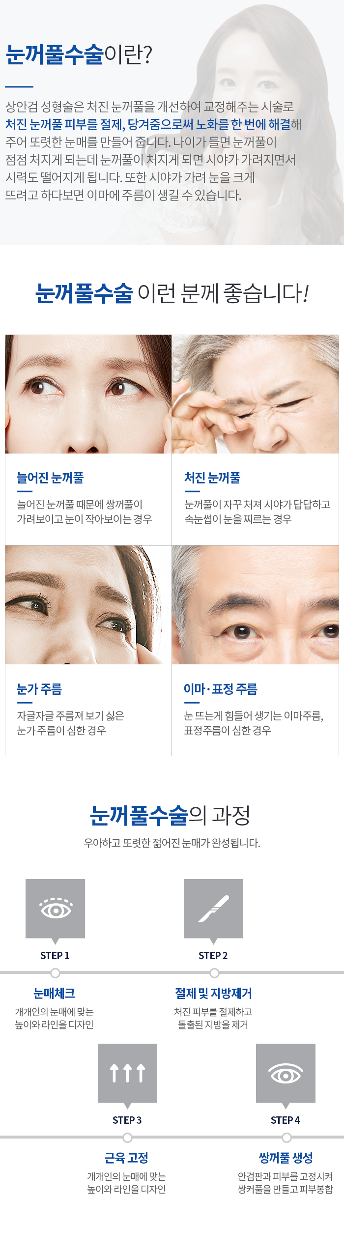 눈꺼풀 수술_m
