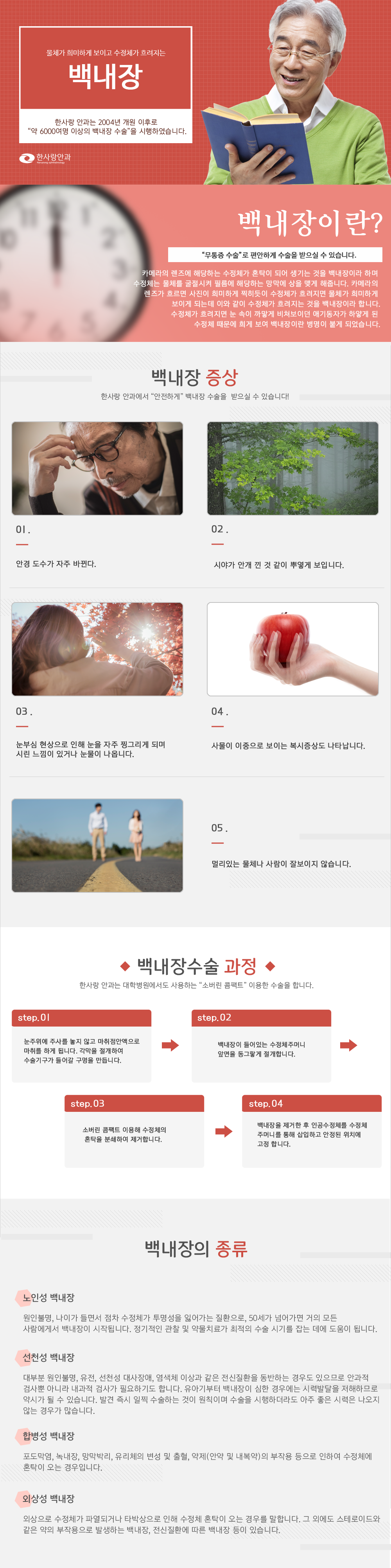 백내장수술